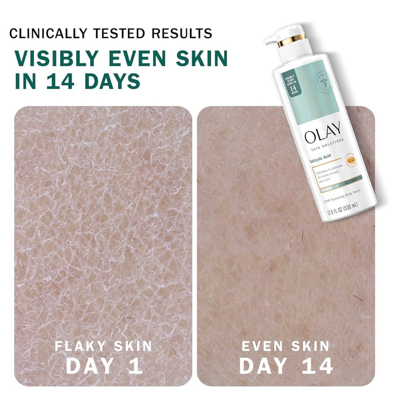 Olay Skin Solutions Hydrating Body Wash with Salicylic Acid (530ml)