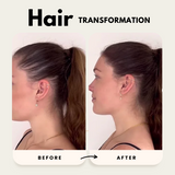 Hair growth before and after – side view