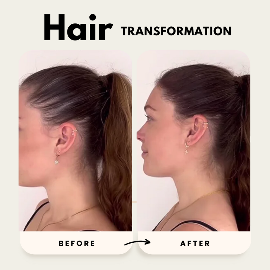 Hair growth before and after – side view