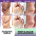 Exfoliating Foot Mask 5-Pack Benjamin Button