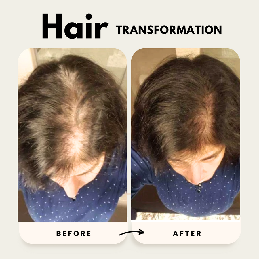 Lustrao Hair Growth Trio Consistency Kit