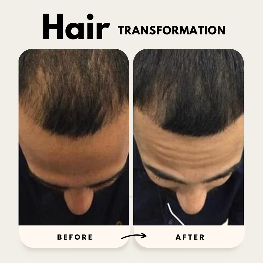 Lustrao Hair Growth Trio Consistency Kit