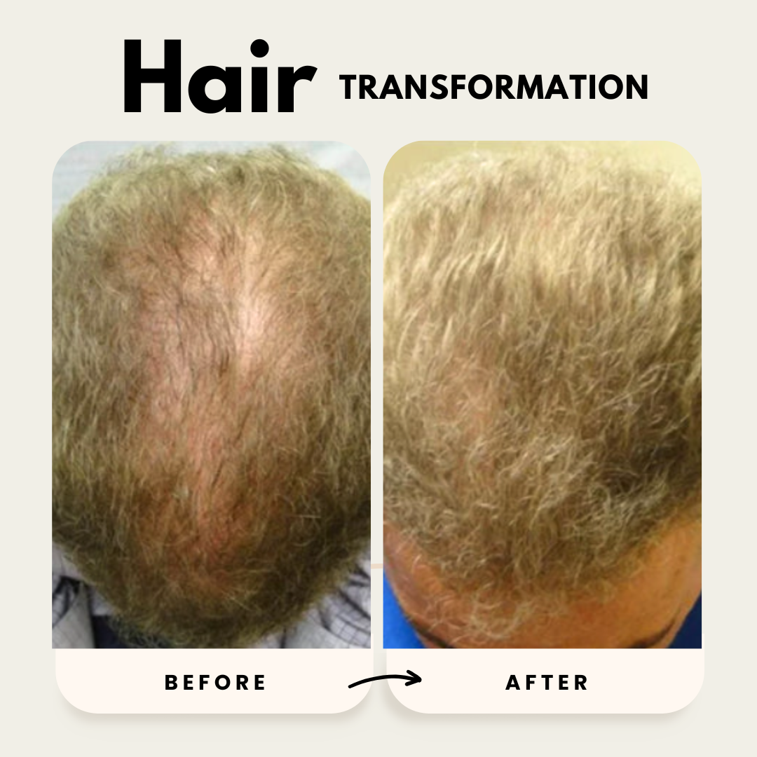 Lustrao Hair Growth Trio Consistency Kit