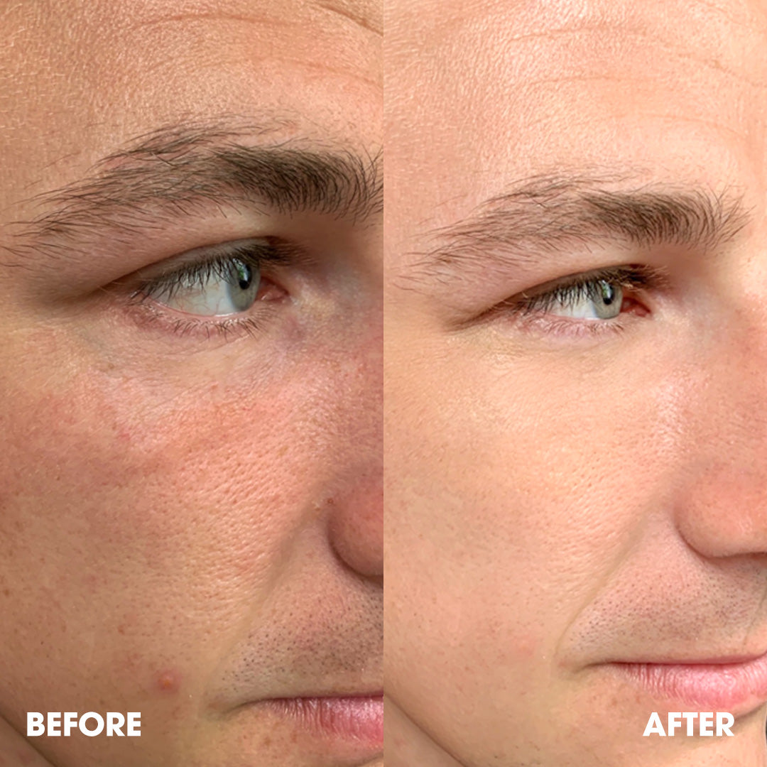 LET’S FACE IT – Tinted Moisturiser SPF25 (BB Cream for Men)