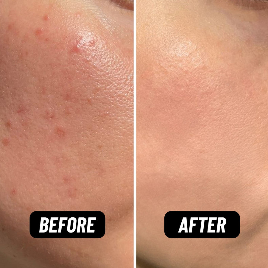 Shake It Up Facial Oil