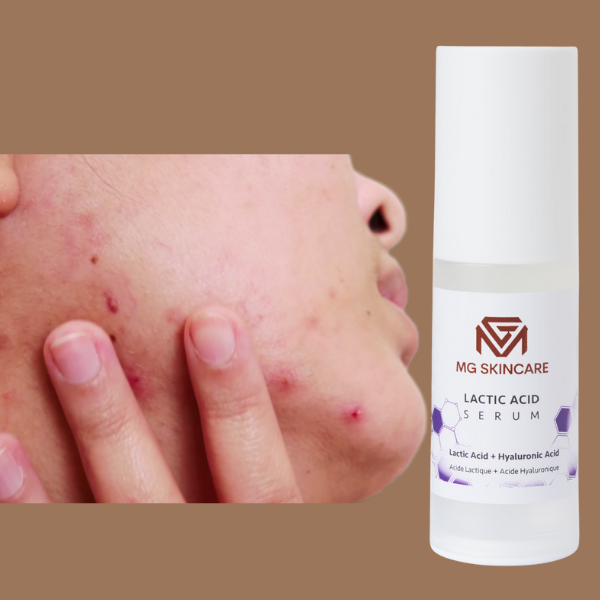 MG Skincare Lactic Acid Serum 10% 30ml