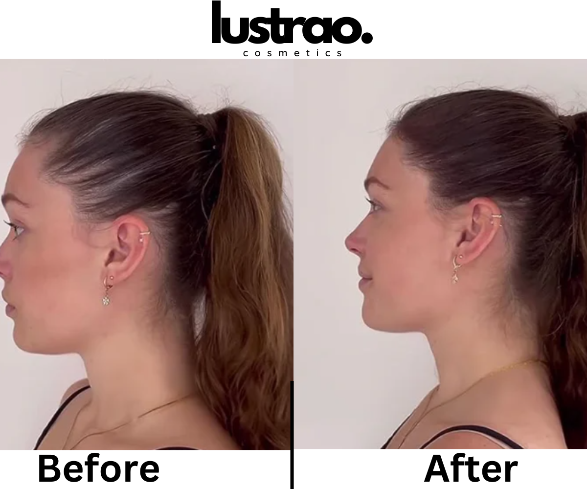Lustrao Hair Regrowth Oil – Follicle Revival