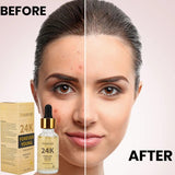 Ammuri 24K Gold Face Serum - Anti-Aging Collagen Booster Dark Circle Treatment