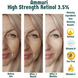 Ammuri Skincare High Strength Retinol Serum - Anti-Aging