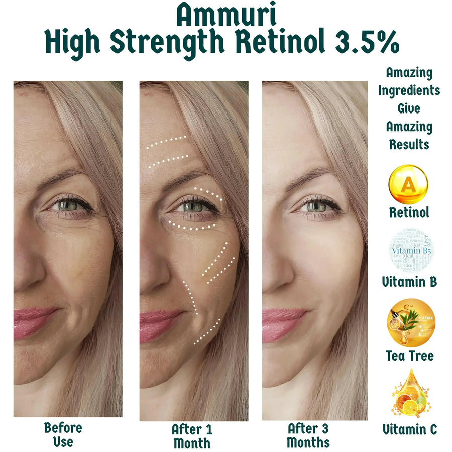 Ammuri Skincare High Strength Retinol Serum - Anti-Aging