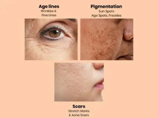 Ammuri Apple Stem Cell Age Reverse Cream