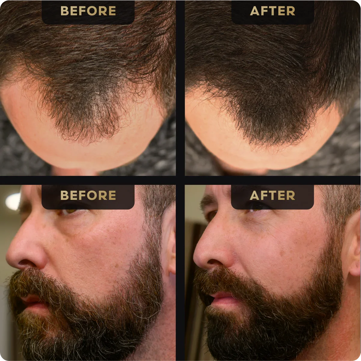 Beard Pen & Hair Concealer Bundle