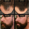 Beard Pen & Hair Concealer Bundle