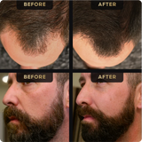 Beard Pen & Hair Concealer Bundle