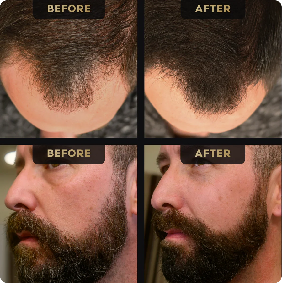 Beard Pen & Hair Concealer Bundle