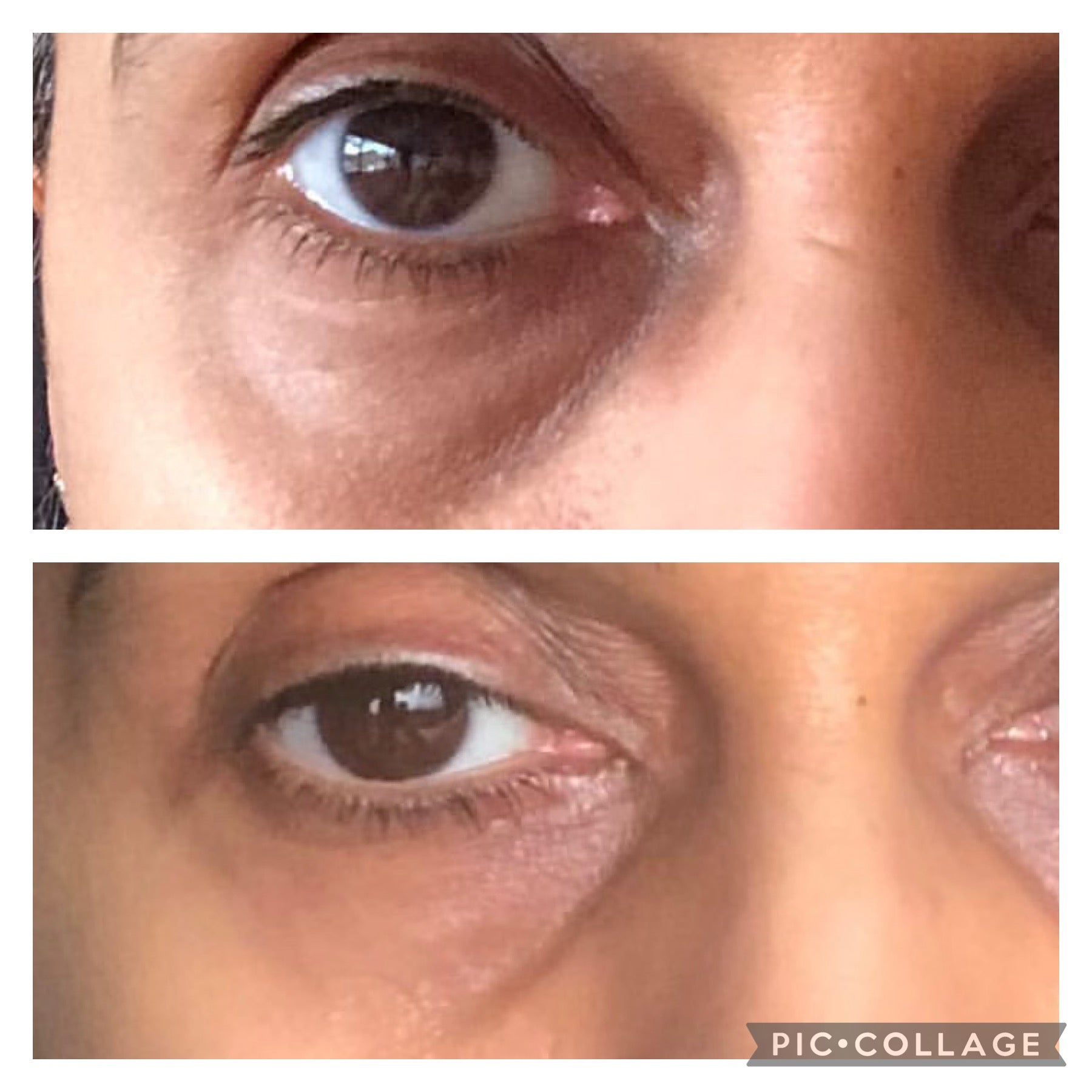 Soloskinlondon Dark Circles Under Eye Oil