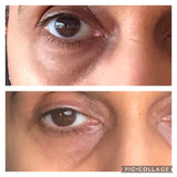 Soloskinlondon Dark Circles Under Eye Oil