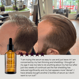 MEGIWellness Hair Serum for Thinning Hair