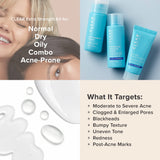 Paula's Choice CLEAR Extra Strength Acne Travel Kit