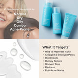 Paula's Choice CLEAR Regular Strength Acne Travel Kit