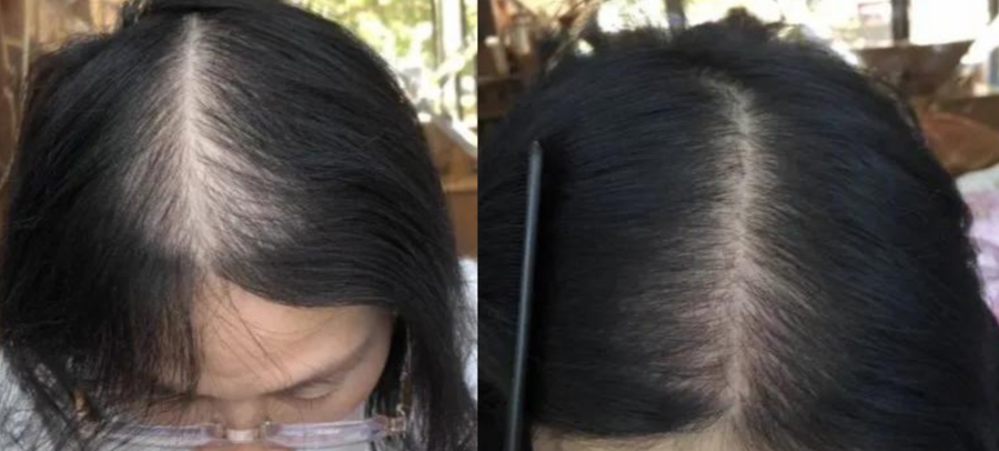 Lustrao Hair Regrowth Oil – Follicle Revival