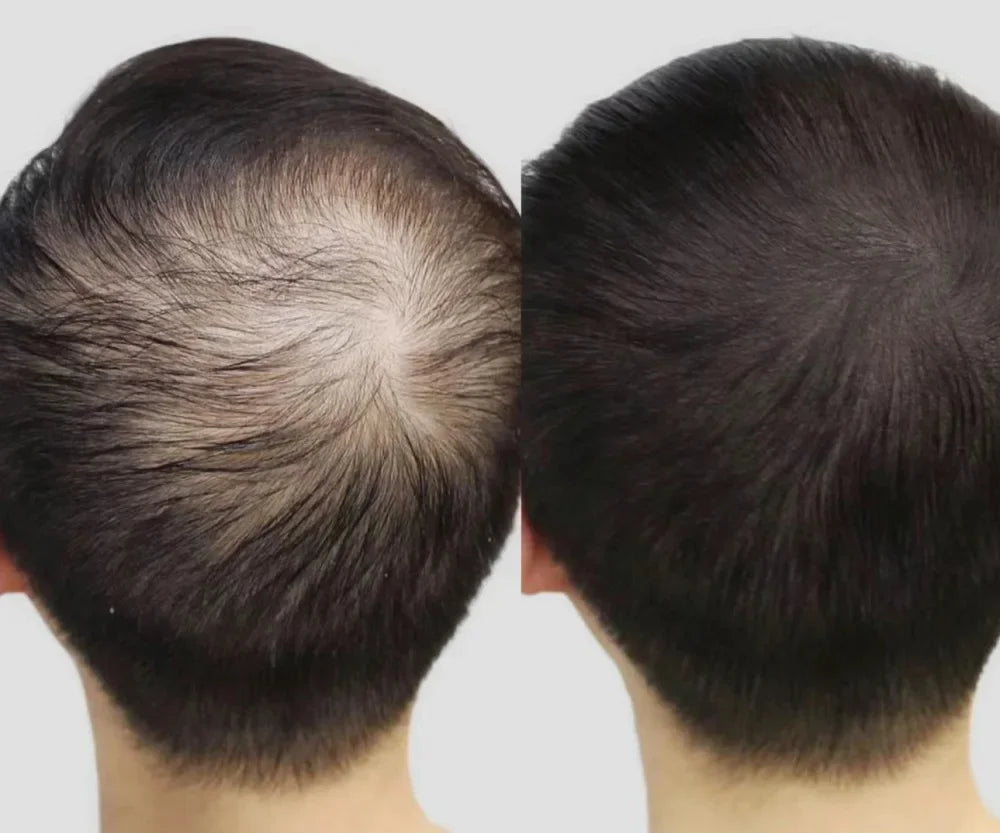 Lustrao Hair Regrowth Oil – Follicle Revival