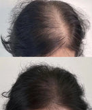 Lustrao Hair Regrowth Oil – Follicle Revival