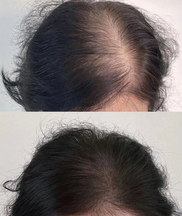 Lustrao Hair Regrowth Oil – Follicle Revival